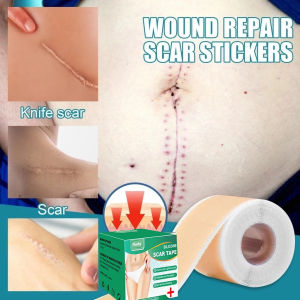 silicone scar sheet 4cm x 1.5m penghilang bekas luka menghilangkan bekas luka di kaki penghilang keloid menonjol scar patch plester bekas luka keloid penghilang bekas luka operasi Caesar bekas luka koreng silikon penghilang keloid bekas luka