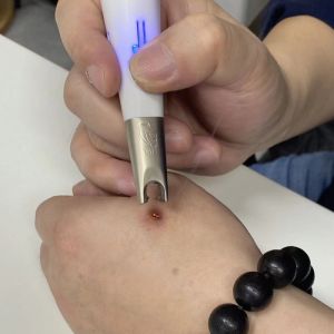 Solid Wood ETA Mold Moxa Handmade Former Moxibustion Hall For Home Ginger-Separated Moxibustion Wheat Grain Navel Moxibustion Board Get 3 Gifts