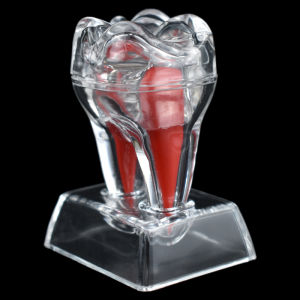 Nha khoa mô hình răng có thể tháo rời mô hình răng miệng giảng dạy mô hình răng hai lớp