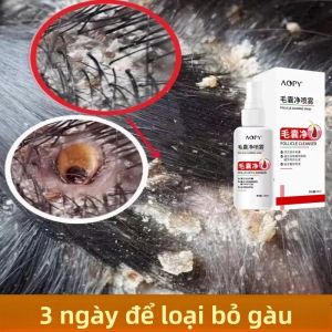 Xịt Dưỡng Da Đầu - Dầu Trị Gàu & Ngứa Kiểm Soát Dầu Phục Hồi Chống Rụng Tóc Chăm Sóc Tóc Khỏe Mạnh Chiết Xuất Từ Thực Vật