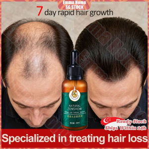🚀SG stock🚀 Ginger hair growth serum / Fast hair growth essence / Ginger hair tonic / Hair loss treatment / Anti hair loss serum