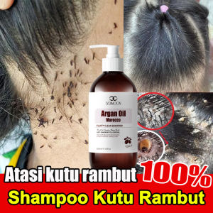 Shampoo Kutu Untuk Anak Dan Dewasa & Sampo Anti Ketombe Dan Gatal 500ml Shampo Kutu Rambut Dan Ketombe Penghilang Kutu/Anti Ketombe Dan Gatal/Sampo Kutu Dan Telurnya
