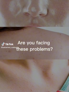 (EXP: 12/2027) SEBAMED Cleansing Bar 150G