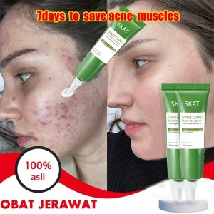 Krim Anti Jerawat Ampuh – Tea Tree Ampuh Atasi Jerawat dan Bekas Jerawat Krim Jerawat Perawatan Kulit Wajah/Penghilang Bekas Jerawat/Penghilang Jerawat/Krim Jerawat dan Salep Herbal Penghilang Bekas Jerawat