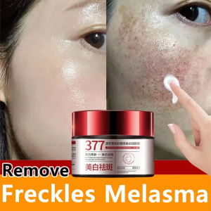 Melasma Cream Freckles Removal Cream 30g Nicotinamide Brighten For Face Dark Spot Remover Reduces Melanin Pigmentation Improves Skin Dullness Anti-Aging
