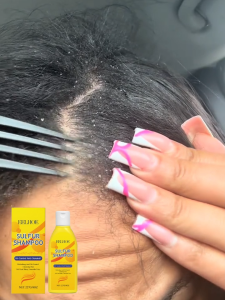 EELHOE 227g Sulfur Oil Control Anti-Dandruff Shampoo with Gentle Cleansing for Oily Hair Tropical