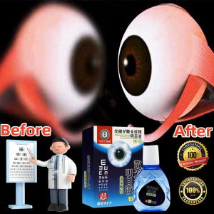 Ready Stock original astigmatism artificial eye drop long lasting moisturizing dry eye titisan mata astigmatisme10ml 眼藥水