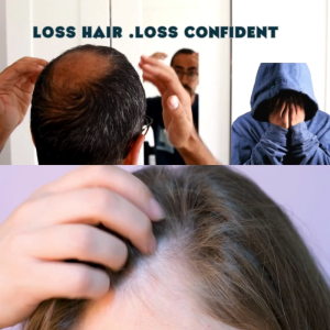 Atomy Root Vital Scalp Care Shampoo | SmartBiome™️ Formula | Hair Loss & Scalp Treatment