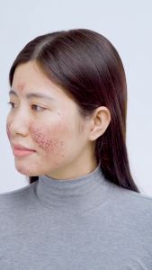 Serum MD CARE Copper Peptide Serum Chống Lão Hóa MD Care Kích Thích Tăng Sinh Collagen Làm Đầy Sẹo 30ml - DuocmyphamDrAn