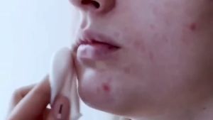 Eelhoe Lactobionic Acid Pore Shrink Face Serum: Mengecilkan Pori-Pori & Memutihkan Wajah