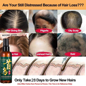 Anti Loss Hair Growth Oil Hair Repair Essence 100ml Hair Growth Serum Roots Booster Tonic Nourishing Moisturising