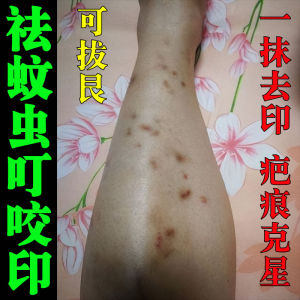 Scars Removal Cream Melanin Exfoliating Bug Bite Fading Scars Black Marks Melanin Removal Scar Cream Gentle on Skin