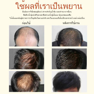 ของแท้ 100%ZENSHOW แชมพูเร่งผมยาว แชมพูแก้ผมร่วง แชมพูขิงเพียว แชมพูลดผมร่วง ยาสระผมแก้ร่วง แชมพูขิงของแท้ Hair loss shampoo ยาสระผมเร่งยาว สูตรน้ำขิง ปลูกผมอย่างอ่อนโยน บำรุงรากผม ปลูกผม เร่งผมเกิดใหม่ ผมยาวไว