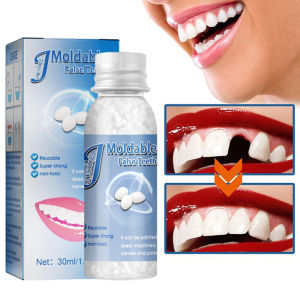 Penambalan Gigi Permanen: Solusi untuk Gigi Berlubang, Ompong, Patah & Bolong