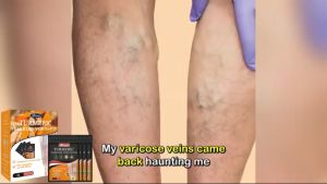 XIMONTH Varicose Vein Patch Varicosity Angiitis Patch Health Care Plaster Varicose Veins Relief Cold Compress Vein Patch 48pcs