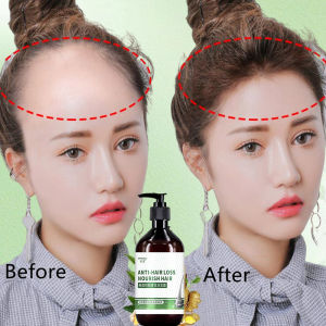 Ginger Hair growth shampoo ginger hair loss scalp original penumbuh rambut gugur 防脱发生发洗发水