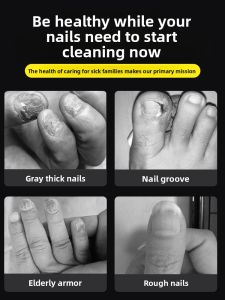 IMLUCKY | Stainless Steel Nail File For Thick Hard Toenails Elderly Grey Nail File Pedicure Tool Cuticle Nippers Nail Clippers