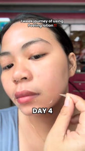 【BUY 2 TAKE 2】SkeenCare Peeling Lotio+Tinted Sunscreen Cream 20X Whitening Set SPF 50 PA+++