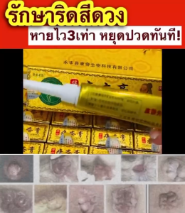 ครีมสมุนไพร ครีมริดสีดวงทวาร