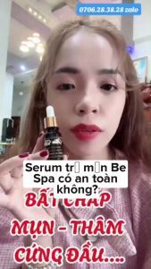 Serum mụn miuspa 10ml Khắc tinh của mụn làm sạch mụn không gây kích ứng không gây sưng không gây nóng da không gây đỏ da và không gây đau