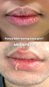 ❤️Ruby & Laura❤️The Originote Lip Oil Serum - Lip Treatment Serum Bibir Melembabkan Mencerahkan Warna Bibir with Ceramide Vitamin C