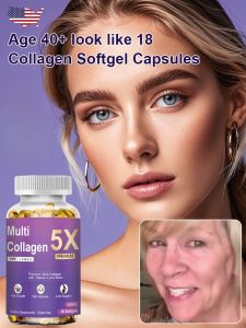 🔥【Age 40+ with a face that looks 18】Whitening and Spot-Removing Collagen Soft Capsules 胶原蛋白软胶囊