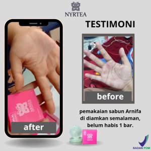 NYRTEA GREEN YOGURT SOAP HQ SABUN PEMUTIH BADAN & WAJAH SIHAT