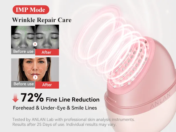 【未使用】ANLAN Rose Lumi ANLAN Rose Lumi Beauty Device 5 Minute Home Skin Care Full Pink