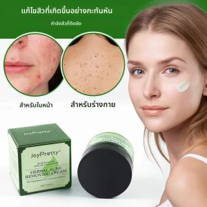 JoyPrettyin สมุนไพรสิวครีมสิว Removal Oil Control Moisturizing Pockmark Smooth ครีมบํารุงผิวหน้า Skin Care ผลิตภัณฑ์