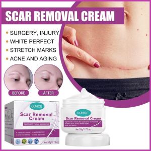 Multi-Purpose Scar Treatment Balm - Reduces Appearance of Dark Scars Burns & Insect Bite Marks - C-Section & Injury Scar Recovery Cream - Parut Hitam Correction