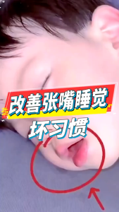 Mouth Breathing Seal Patch 嘴巴呼吸闭口贴 Pelekat Anti-Dengkuran Kapas Cotton Anti-snoring Adults Children