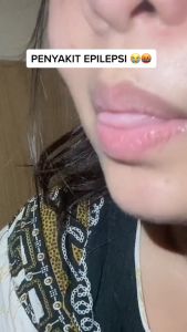 ETHERAL BHARATA ORIGINAL Obat Epilepsi Ampuh Anak Dan Dewasa