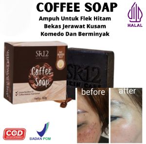 Sabun flek hitam paling ampuh sabun flek membandel sabun flek hitam tebal susah putih sabun flek hitam asli original Bpom