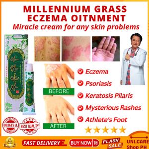 100% EFFECTIVE MIRACLE Cream Original MlLLENNlUM⭐⭐⭐ Psoriasis Eczema Rosacea Acne Keratosis Pilaris Rashes Fungal Infections Athletes Foot Ringworm Dermatitis Women Genital Itching Hemorrhoids Scabies Atoderma Cream Ointment for Itchy Skin and Allergy