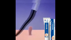 100% ORIGINAL Japan Warts Removal Cream Skin Tag Remover Painless Mole corn remover Genital warts remover Safe & Effective HPV Removal 30G