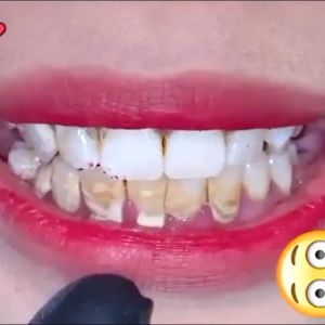Pemutih Pasta Gigi Probiotik SP7 120g Pemutih Gigi Kuning Penghilang Karang Gigi 100% ori Odol pemutih gigi dan karang gigi Ubat Gigi Pemutih Probiotik Peningkatan Baru Nafas Segar Menghilangkan Karang Gigi Mencegah Kerusakan Gigi Melindungi Gusi