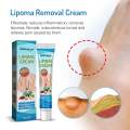 SOUTHMOON LIPOMA REMOVAL CREAM krim pembersih lipoma limfa ketulan keras ketiak leher belakang telinga buang detox badan. 