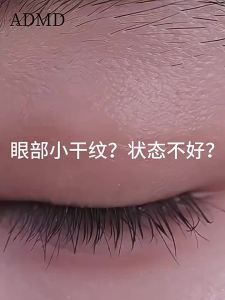 Improve Eye Skin Firming Light Lines Rollerball Eye Cream Serum Oil Eye Serum Oil Lutein