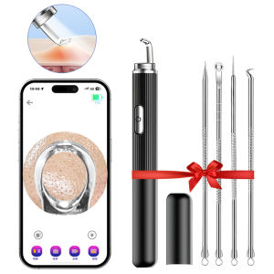 เครื่องทำความสะอาดสิวรูขุมขน Comedone เครื่องสกัดหัวสิวสีขาวเครื่องกำจัดสิวหัวดำไฟฟ้ามีที่กดสิว1296P กล้อง HD เครื่องกำจัดสิวหัวดำภาพขยาย50X