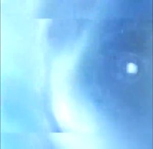 Pasta Gigi Probiotik SP-5: Solusi Gigi Putih & Sehat