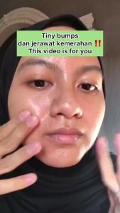 SKINTIFIC 2% Salicylic Acid Anti Acne Serum 20ml Serum Jerawat Melembabkan wajah Facial Serum