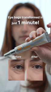 Dr.Melaxin Eyephalt Retinol Eyebag Cream 10g Korean Anti-Aging Eye Care Retinol + Collagen Formula Visibly Tighten Saggy Under Eyes Eliminate Puffy Eye Bags & Crow’s Feet Wrinkles