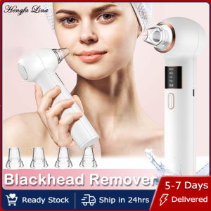 Hengfa Lina Acne Blackhead Remover Face Pore Vacuum Suction Cleaner Facial Cleaner Comedone Pimple Extractor Tool With Hot Compress Function