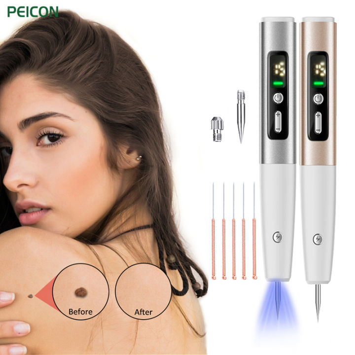 Skin Tag Remover 15 Level Laser Plasma Pen Freckle Mole Warts Removal ...