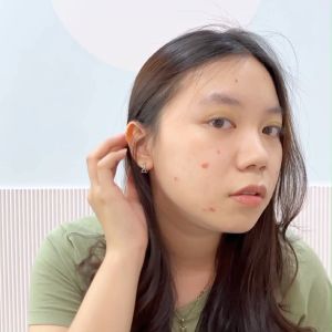 Dorskin Pimple Power Cover - Obat Totol Jerawat Peel Off Acne Spot Care\\n\\n Apa itu Dorskin Pimple Power Cover?\\n\\nDorskin Pimple Power Cover adalah produk perawatan jerawat yang dirancang khusus untuk meredakan dan menutupi jerawat. Produk ini merupakan obat totol jerawat peel off yang efektif dalam mengurangi noda hitam dan bekas luka akibat jerawat. Dengan bahan-bahan alami yang aman dan efektif, Dorskin Pimple Power Cover membantu Anda mendapatkan kulit wajah yang sehat dan bersih.\\n\\n Manfaat Obat Totol Jerawat Peel Off\\n\\nDorskin Pimple Power Cover memiliki berbagai manfaat bagi kulit wajah, antara lain:\\n\\n- Mengurangi peradangan dan pembengkakan pada jerawat\\n- Membantu mengeringkan jerawat dengan cepat\\n- Mengurangi noda hitam dan bekas luka akibat jerawat\\n- Melindungi kulit wajah dari infeksi dan iritasi\\n\\n Cara Kerja Dorskin Pimple Power Cover\\n\\nDorskin Pimple Power Cover bekerja dengan cara membentuk lapisan tipis pada jerawat yang dapat membantu mengeringkan jerawat dan mencegah infeksi. Lapisan ini akan terpisah saat dihapus, membawa kotoran dan minyak berlebih yang menyumbat pori-pori kulit.\\n\\n Perawatan Jerawat Efektif dengan Dorskin Pimple Power Cover\\n\\nBerikut langkah-langkah penggunaan Dorskin Pimple Power Cover untuk mendapatkan hasil terbaik:\\n\\n1. Bersihkan wajah dengan pembersih wajah yang sesuai dengan jenis kulit Anda.\\n2. Oleskan Dorskin Pimple Power Cover secara tipis pada jerawat yang ingin ditutupi.\\n3. Biarkan produk tersebut mengering selama beberapa menit.\\n4. Hapus lapisan Dorskin Pimple Power Cover dengan lembut menggunakan kapas atau tisu basah.\\n5. Ulangi proses ini sesuai kebutuhan hingga jerawat hilang.\\n\\n Tips & Trik Perawatan Jerawat\\n\\nBerikut beberapa tips dan trik tambahan untuk mendapatkan hasil terbaik dalam merawat jerawat:\\n\\n- Jangan menyentuh atau memencet jerawat, karena hal tersebut dapat menyebabkan infeksi dan iritasi.\\n- Gunakan produk perawatan wajah yang sesuai dengan jenis kulit Anda.\\n- Konsumsi makanan sehat dan minum air putih yang cukup untuk menjaga kesehatan kulit.\\n- Cuci tangan secara rutin sebelum menyentuh wajah.\\n\\n Obat Jerawat Alami & Dorskin Pimple Power Cover\\n\\nSelain menggunakan Dorskin Pimple Power Cover, Anda juga dapat mencoba obat jerawat alami untuk mendapatkan hasil yang lebih maksimal. Berikut beberapa manfaat penggunaan obat jerawat alami:\\n\\n- Lebih aman dan tidak menyebabkan efek samping\\n- Mengandung bahan-bahan alami yang aman untuk kulit\\n- Dapat digunakan sebagai alternatif jika Anda memiliki alergi terhadap bahan kimia dalam produk perawatan wajah\\n\\n Menggabungkan Dorskin Pimple Power Cover dengan Perawatan Jerawat Alami\\n\\nAnda dapat menggabungkan penggunaan Dorskin Pimple Power Cover dengan perawatan jerawat alami untuk mendapatkan hasil yang lebih maksimal. Berikut beberapa cara yang dapat Anda coba:\\n\\n- Gunakan masker alami seperti lidah buaya atau madu sebelum menggunakan Dorskin Pimple Power Cover.\\n- Oleskan toner alami seperti air lemon atau air kelapa pada wajah setelah menggunakan Dorskin Pimple Power Cover.\\n- Konsumsi makanan sehat yang kaya akan vitamin dan mineral untuk mendukung kesehatan kulit.\\n\\nDengan mengikuti langkah-langkah penggunaan Dorskin Pimple Power Cover dan tips perawatan jerawat alami, Anda dapat mendapatkan kulit wajah yang sehat dan bersih. Jangan ragu untuk mencoba dan temukan apa yang paling cocok untuk kulit Anda!\"