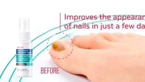 Dr.ville Original Nail Fungus Treatment Spray Japan Nail Repair Serum 100% Authentic Stop Fungal Growth Effective Toenail Health Care 灰指甲治疗液 30ml