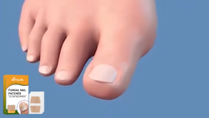Ximonth Nail Moisturizing Patches Improve Nail Surface Condition Portable Nail Care Product