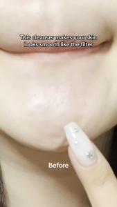 ANUA Heartleaf Quercetinol Pore Deep Cleansing Foam 150ml | Suitable for all skin types including those prone to acne