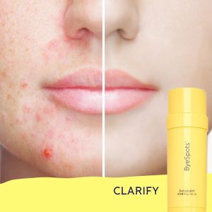 Bebebalm Scar Rescue Bye Spots 4.5g / 60g Scar Pimple Stretchmark Anti-aging Dark spots Burn Keloid Bruise