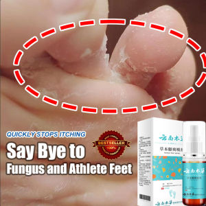 anti fungal spray foot spray foot care foot odor spray 50ml Feet Reducing Bacteria Say Bye to Fungus and Athlete Feet for a Healthy Feet